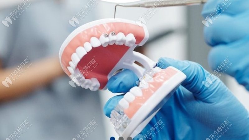 上海正规口腔诊所预约挂号，这些步骤你了解吗？**