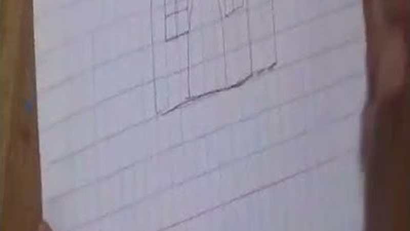 种植牙与假牙价格差异解析**